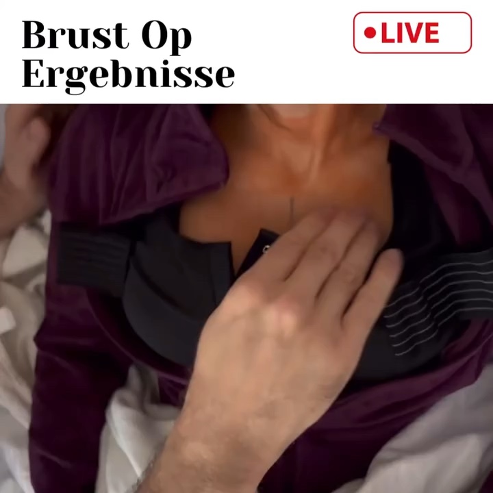 Patientin zeigt im Gespräch den bekleideten Dekolletébereich