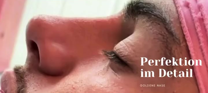 Einzelaufnahme der Nase aus dem Beitrag zur Goldenen Nase