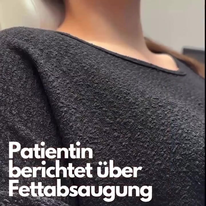 Bekleidete Patientin erzählt über ihre Erfahrung mit einer Fettabsaugung