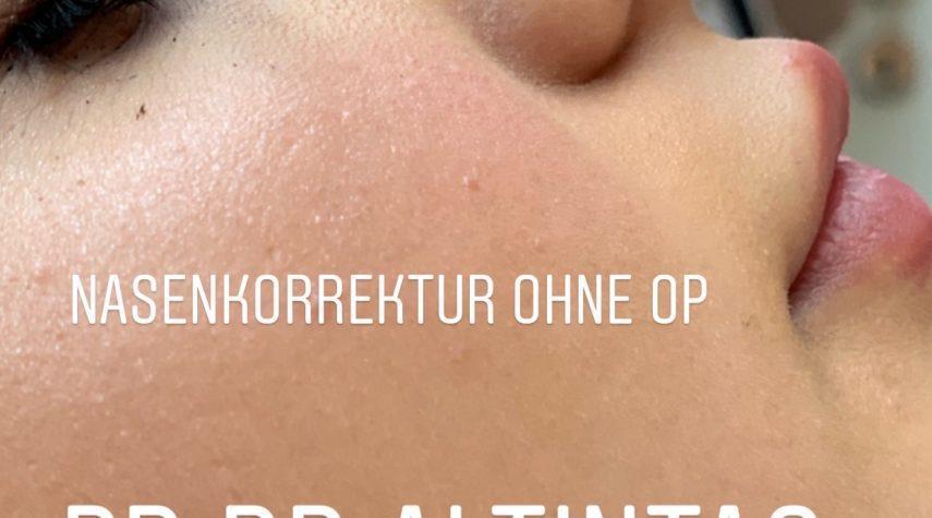 Nase ohne OP Oberbilk