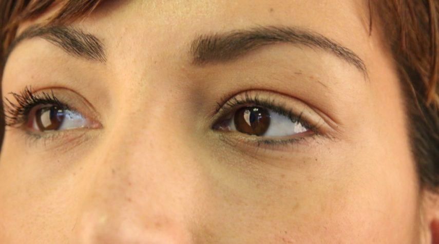 Augenringe entfernen Nürnbrecht