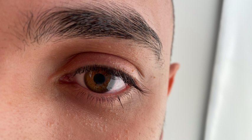 Augenringe entfernen Iserlohn