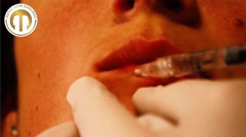 Welches Hyaluron bei Lippen aufspritzen?